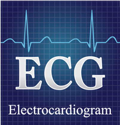 Electrocardiogram (ECG) Services